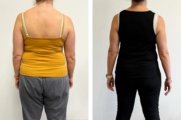 Accompagnement perte de poids chez Best Life Nutrition, à Plescop